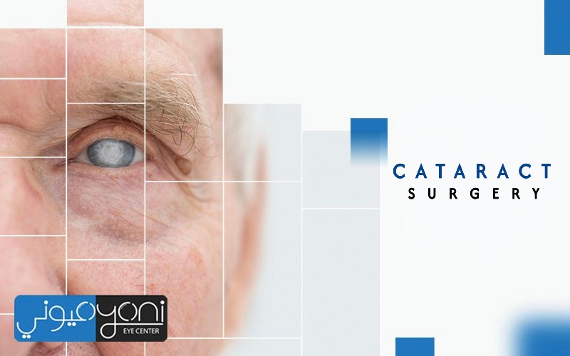 Cataract Surgery