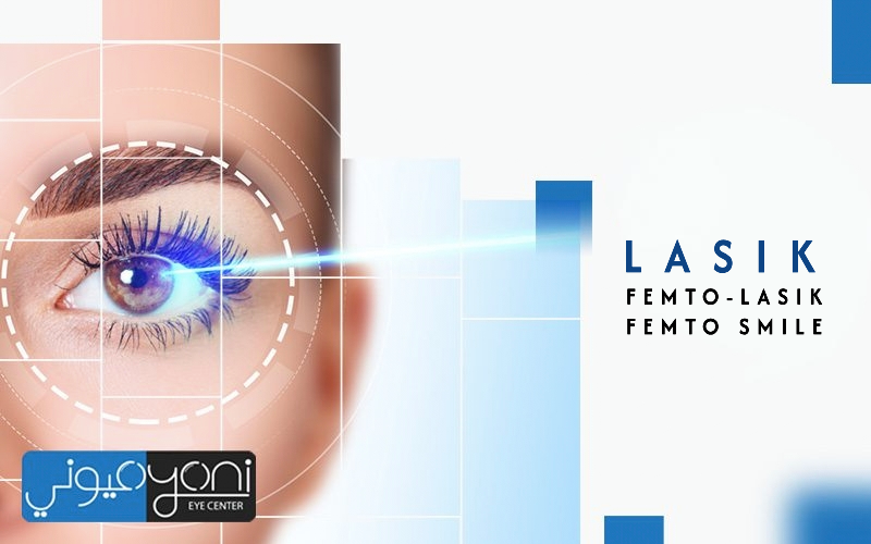 LASIK, Femto-LASIK, and Femto-Smile and the Difference Between Them