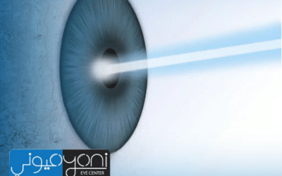 Ultra LASIK vs Femto LASIK: Understanding the Key Differences Before Laser Eye Surgery
