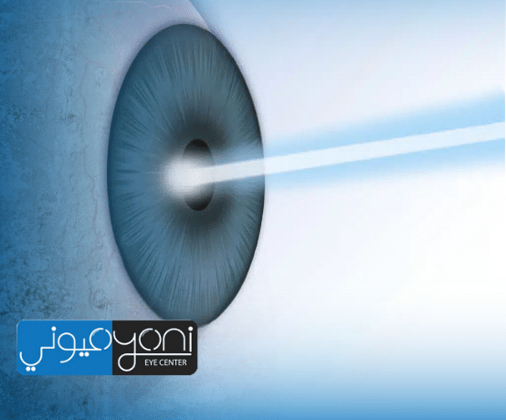 Ultra LASIK vs Femto LASIK: Understanding the Key Differences Before Laser Eye Surgery