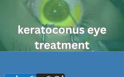 Keratoconus Eye Treatment
