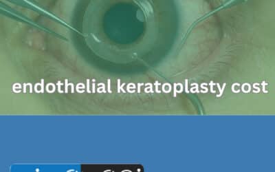 Endothelial Keratoplasty Cost