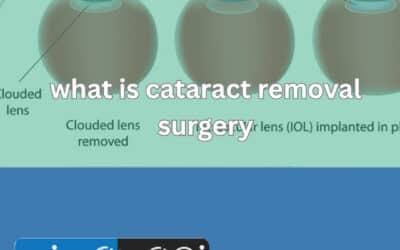 What Is Cataract Removal Surgery