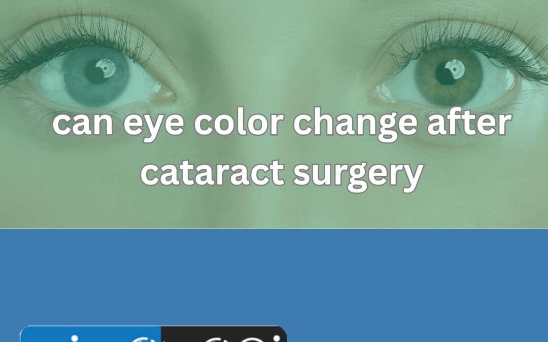Can Eye Color Change After Cataract Surgery