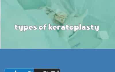 types of keratoplasty