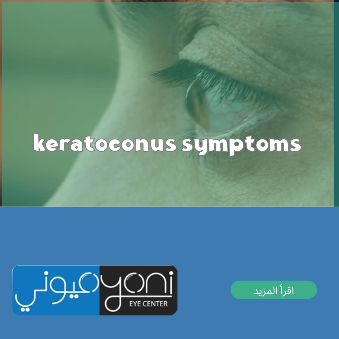 keratoconus symptoms