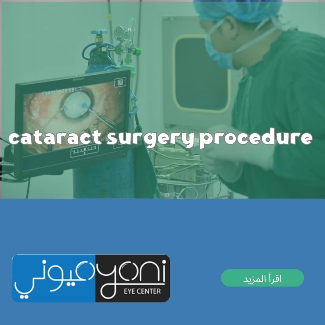 cataract surgery procedure