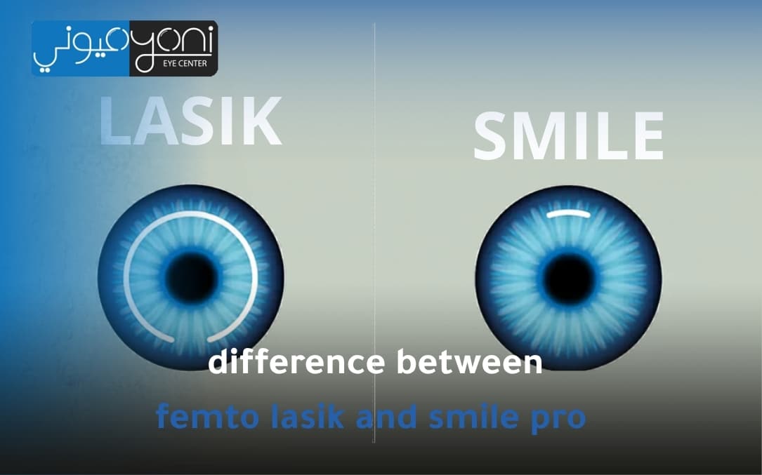 difference between femto lasik and smile pro