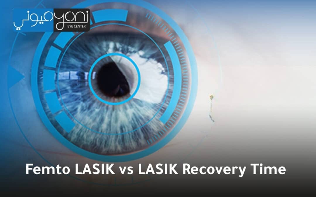 Femto LASIK vs LASIK Recovery Time