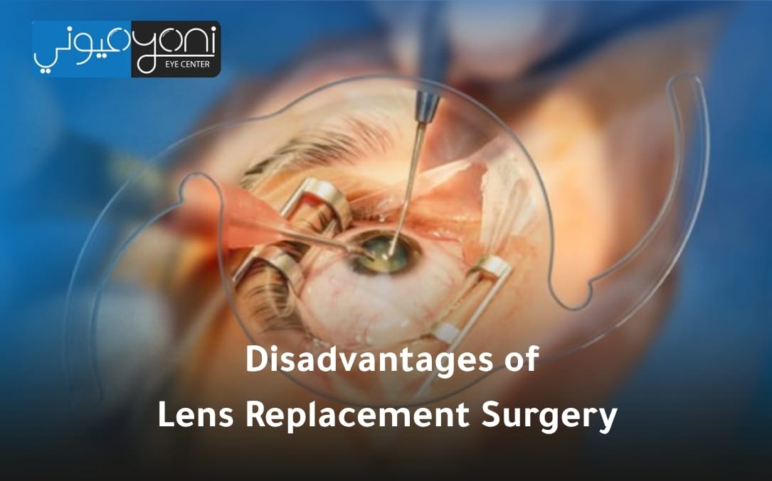 disadvantages of lens replacement surgery