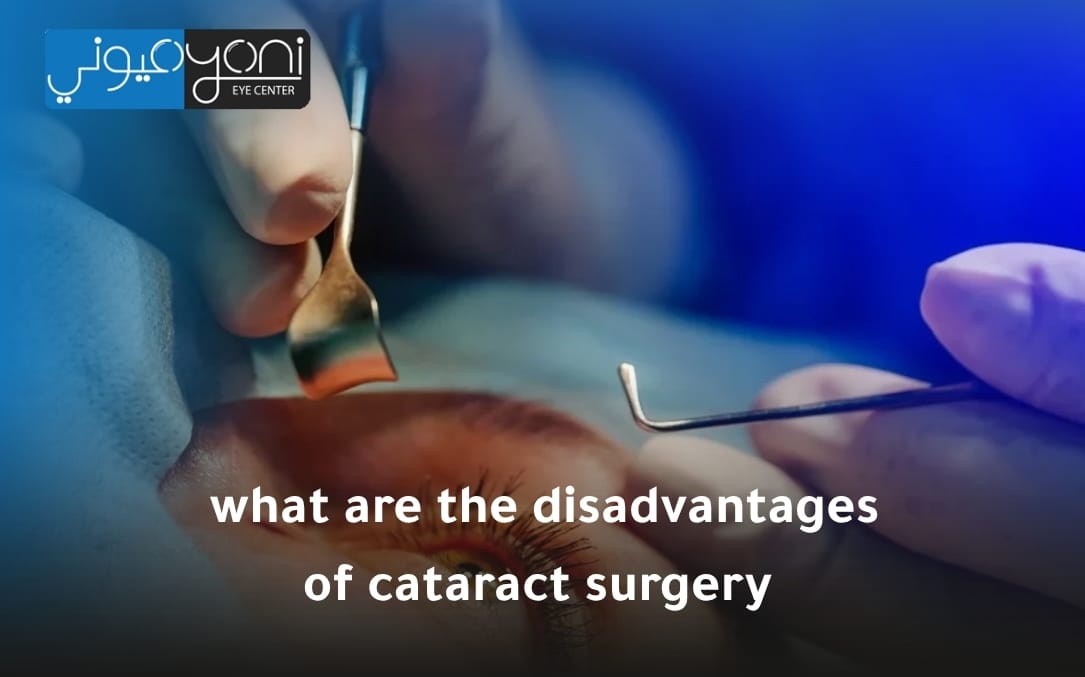 what are the disadvantages of cataract surgery