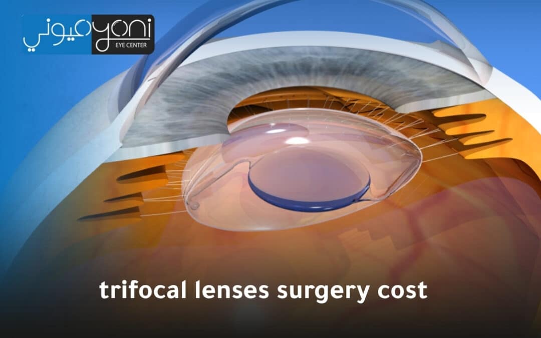 Trifocal Lenses Surgery Costs