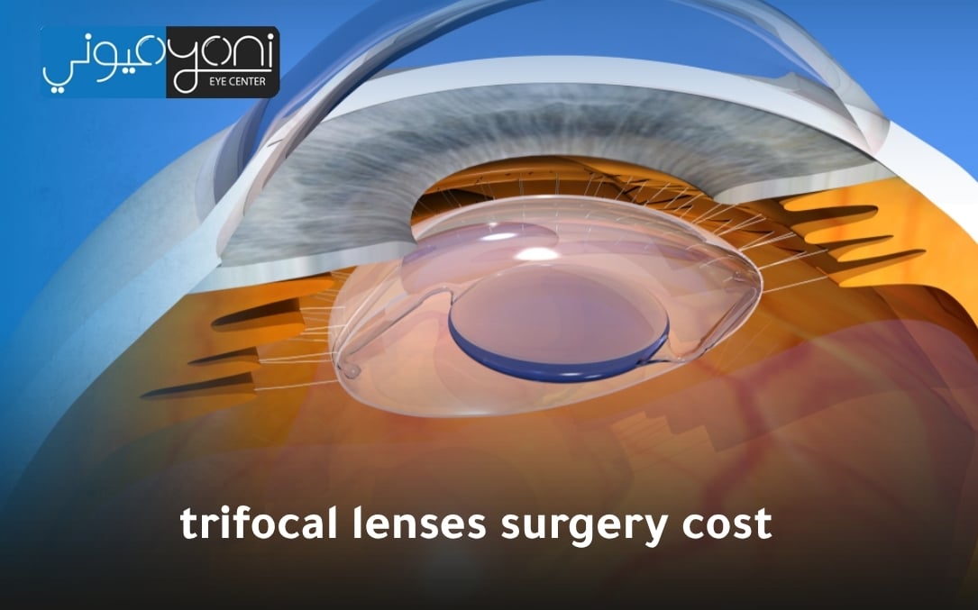 trifocal lenses surgery cost