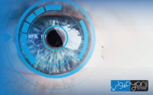 femto lasik disadvantages