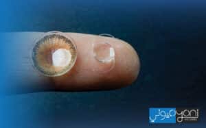 disadvantages of lens replacement surgery