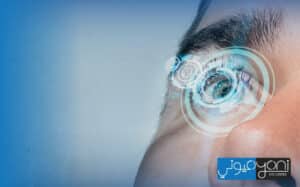 trifocal lenses surgery cost