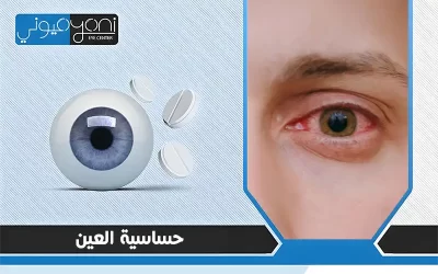 حساسية العين