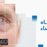 تفاصيل عملية المياه البيضاء Cataract Surgery