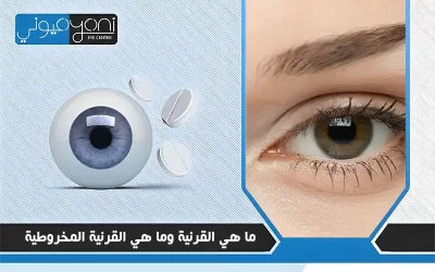 ما هي القرنية وما هي القرنية المخروطية