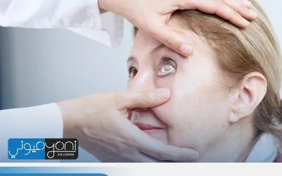 اضرار المياه البيضاء في العين