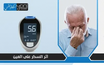 اثر السكر على العين: مضاعفات خطيرة تضر بصحة عينيك