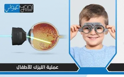 عملية الليزك للاطفال: خُطوة تتطلب التمهل أم التعجل؟