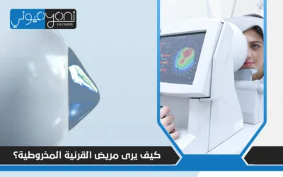كيف يرى مريض القرنية المخروطية؟ لحظات واقعية قبل وبعد الجراحة