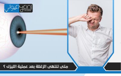 متى تنتهي الزغللة بعد عملية الليزك؟ وما أسباب زغللة العين؟