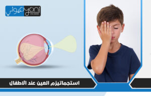 استجماتيزم العين عند الاطفال