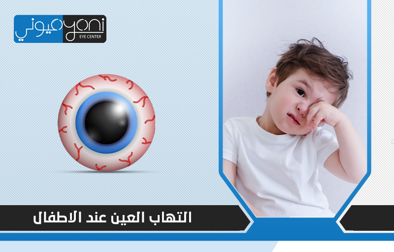 التهاب العين عند الاطفال