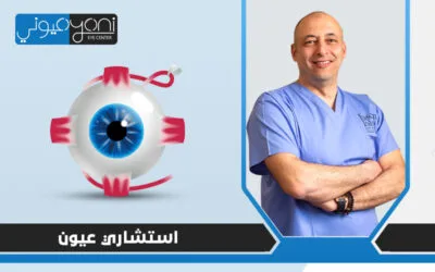 هل جراحة المياه البيضاء تستدعي اللجوء إلى استشاري عيون؟