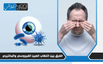 الفرق بين التهاب العين الفيروسي والبكتيري و كيف أميز بينهم