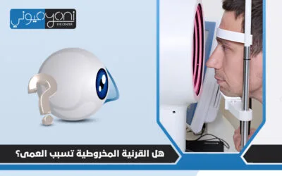 هل القرنية المخروطية تسبب العمى؟ وهل هي مرض وراثي؟