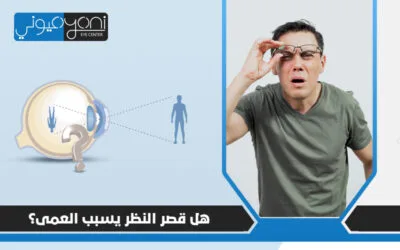 هل قصر النظر يسبب العمى؟