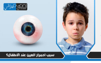تعرف على سبب احمرار العين عند الاطفال
