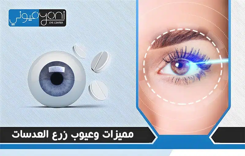 مميزات وعيوب زرع العدسات