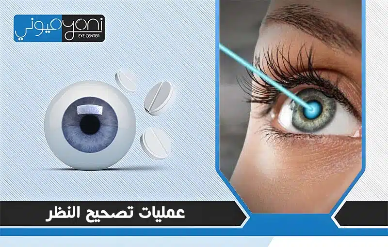 عملية تصحيح النظر