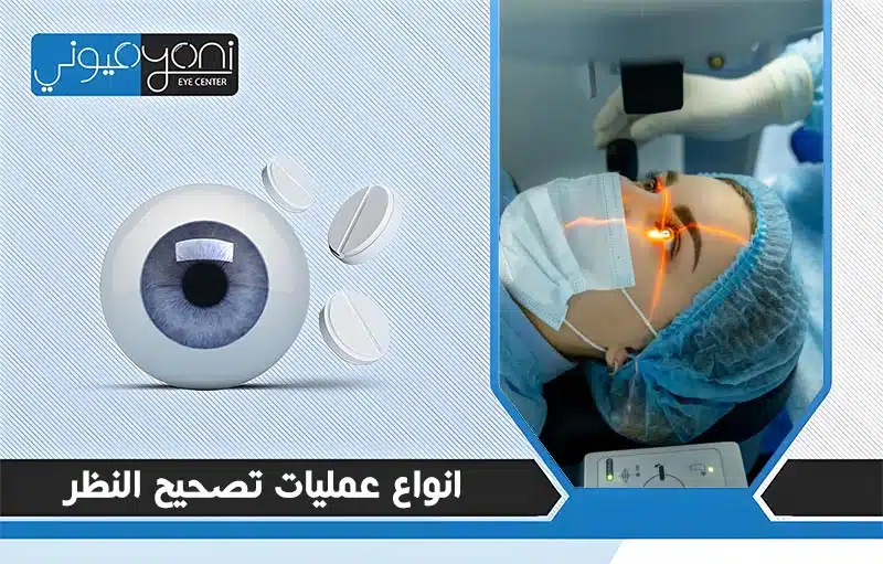 انواع عمليات تصحيح النظر