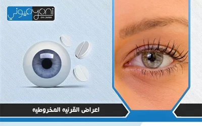 اعراض القرنيه المخروطيه
