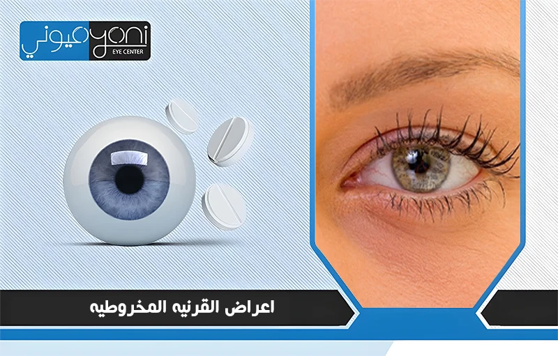 اعراض القرنيه المخروطيه