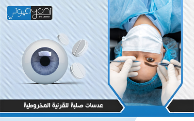 عدسات صلبة للقرنية المخروطية