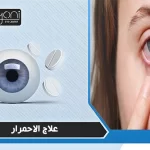أعراض ارتشاح العين