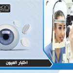 اختبار العيون
