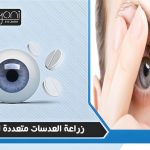 زراعة العدسات متعددة البؤر