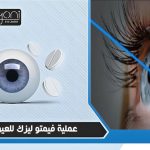 عملية فيمتو ليزك للعيون