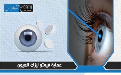 عملية فيمتو ليزك للعيون