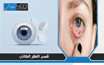 قصر النظر الكاذب