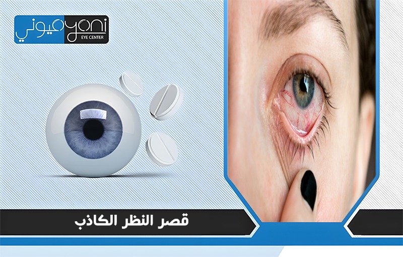 قصر النظر الكاذب
