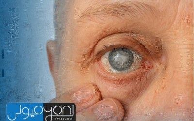 ما هي الآثار الجانبية لعملية المياه البيضاء