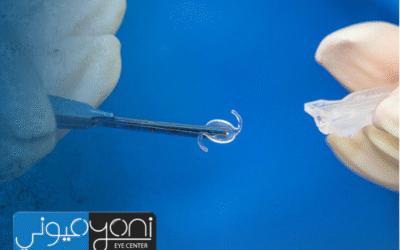 نصائح بعد عملية زراعة العدسات